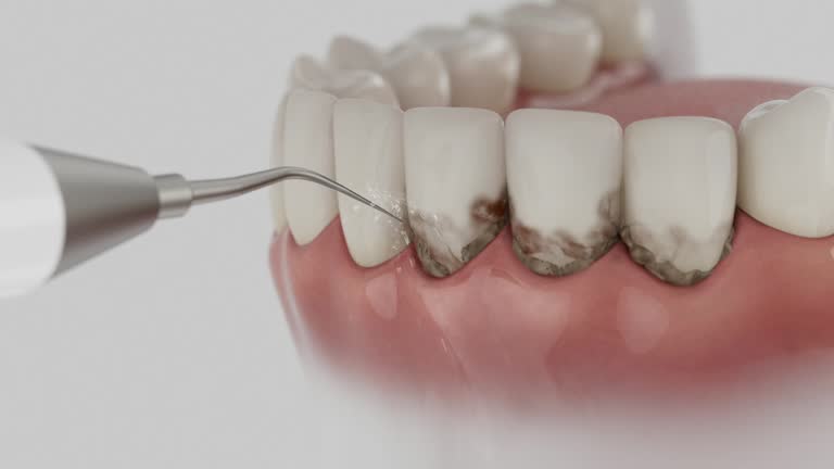 Reliable Emergency Dentist contractor in Addison, WV by Smile Center Dentistry